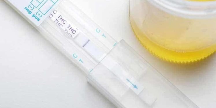 Does HHC Show Up on a Drug Test?