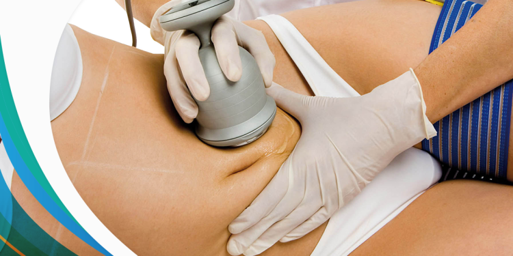 What Exactly Is Meant By “Water Assisted Liposuction”?