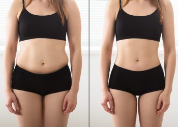 Smart Lipo: What Is It and How Does It Work?