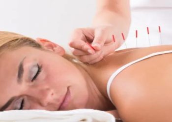 14 Benefits Of Acupuncture: The Mind/Body Connection