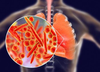 What Is Pneumonia?