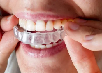 Can Aligners Treat an Overbite?