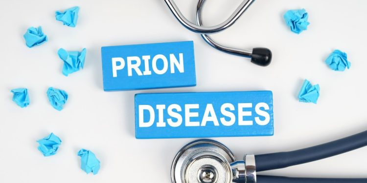 How Are TSEs Diagnosed? Advances in Detecting Prion Diseases