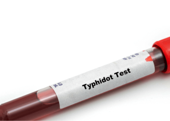 The Importance of Typhoid and Creatinine Tests for Your Health