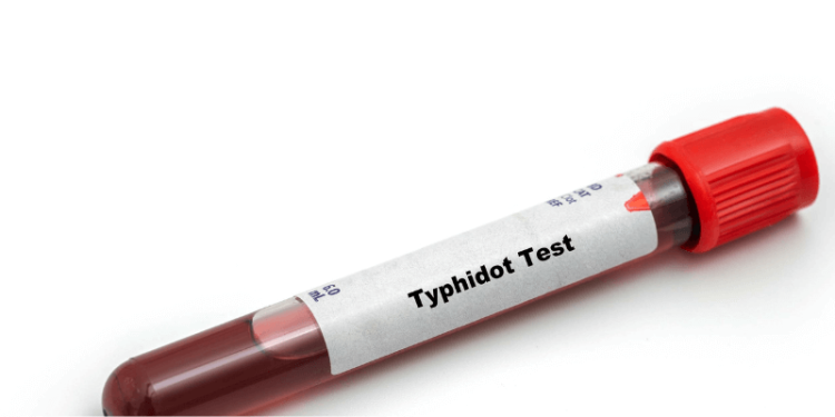 The Importance of Typhoid and Creatinine Tests for Your Health