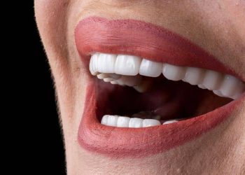 Enhancing Smiles with Modern Dental Crown Solutions