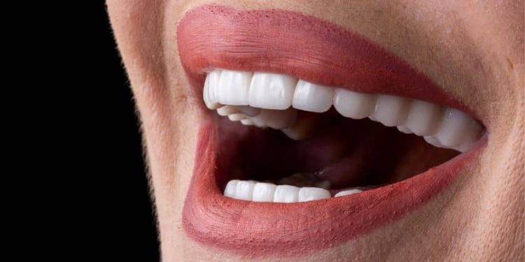 Enhancing Smiles with Modern Dental Crown Solutions